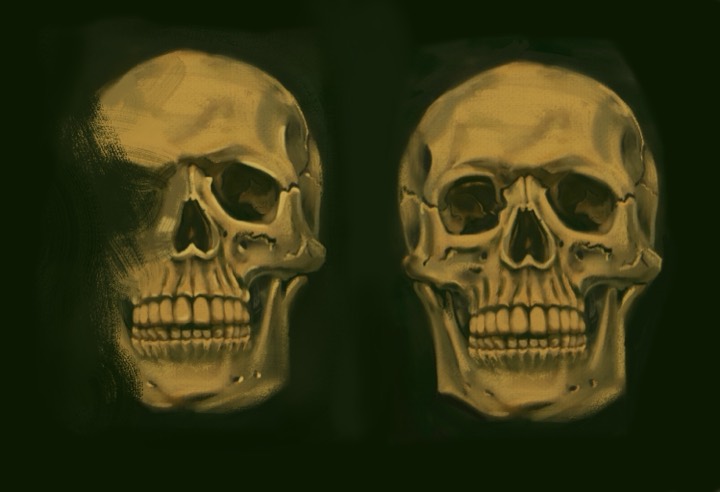 Double skull study